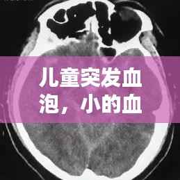 儿童突发血泡，小的血泡 